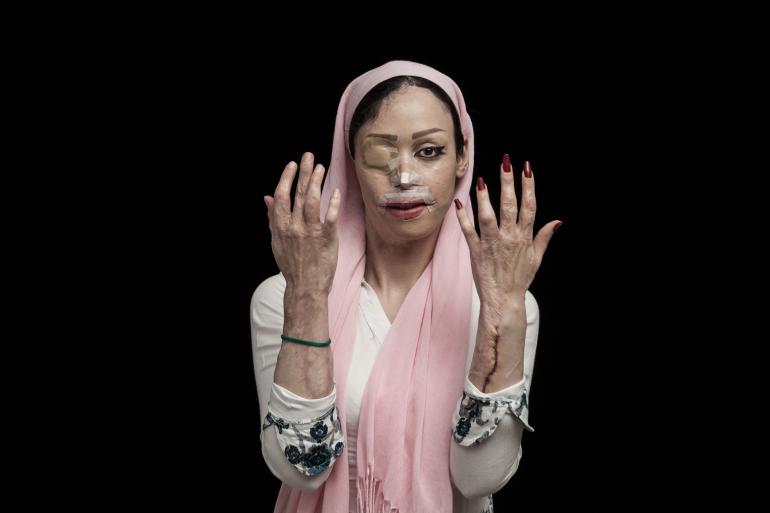 Sony World Photography Awards 2016: Iranischer Fotograf holt Gesamtsieg mit ergreifenden Porträts